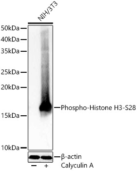 Phospho-Histone H3-S28 Rabbit Polyclonal Antibody - Image 4