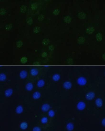 Phospho-Histone H3-S28 Rabbit Polyclonal Antibody - Image 5