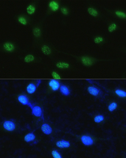 Phospho-Histone H3-S28 Rabbit Polyclonal Antibody - Image 6