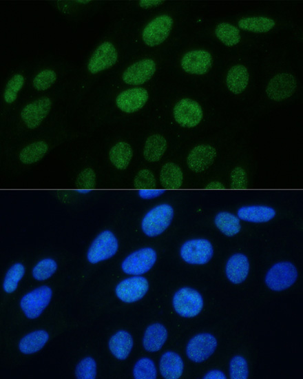 Phospho-Histone H3-S28 Rabbit Polyclonal Antibody - Image 7