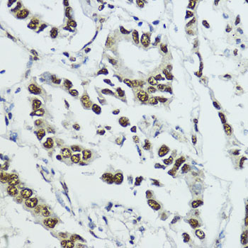 Phospho-Histone H3-T11 Rabbit Polyclonal Antibody - Image 2