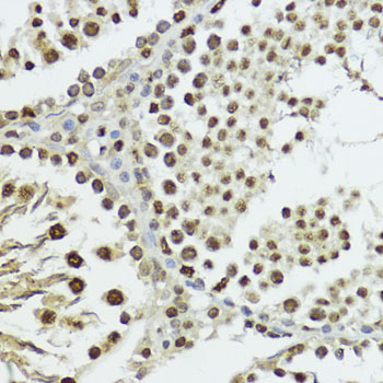 Phospho-Histone H3-T11 Rabbit Polyclonal Antibody - Image 3