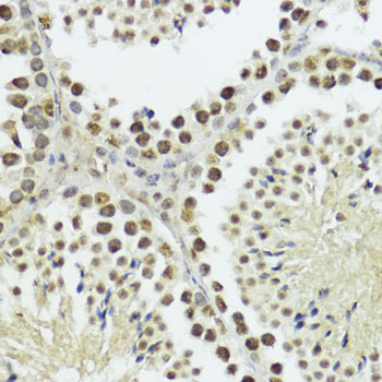 Phospho-Histone H3-T11 Rabbit Polyclonal Antibody - Image 4