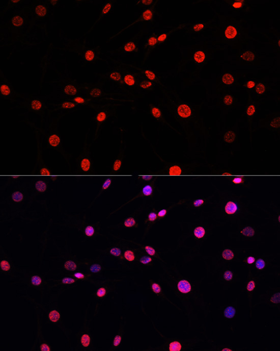 Phospho-Histone H3-T11 Rabbit Polyclonal Antibody - Image 5