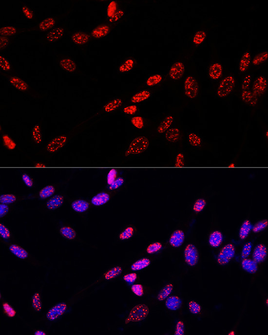 Phospho-Histone H3-T11 Rabbit Polyclonal Antibody - Image 6