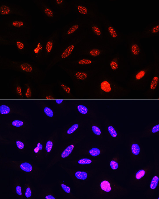 Phospho-Histone H3-T11 Rabbit Polyclonal Antibody - Image 7