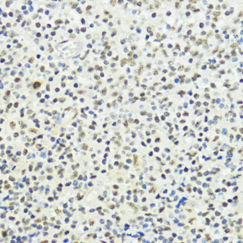 Phospho-Histone H3-T32 Rabbit Polyclonal Antibody