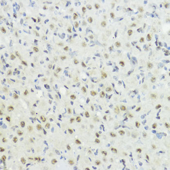 Phospho-Histone H3-T32 Rabbit Polyclonal Antibody - Image 2