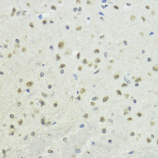 Phospho-Histone H3-T32 Rabbit Polyclonal Antibody - Image 3