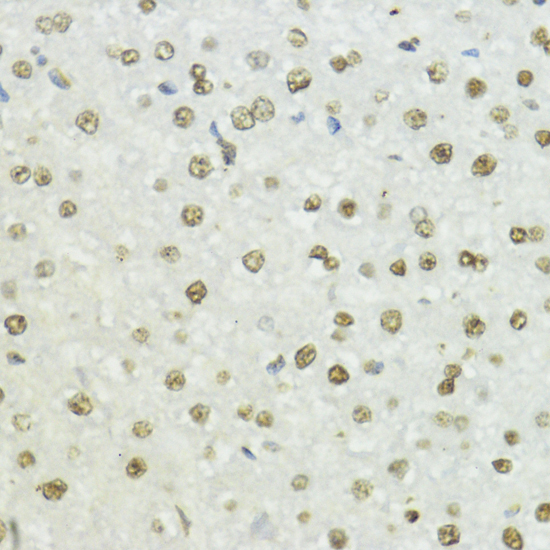Phospho-Histone H3-T45 Rabbit Polyclonal Antibody - Image 3