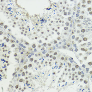 Phospho-Histone H3-T45 Rabbit Polyclonal Antibody - Image 4