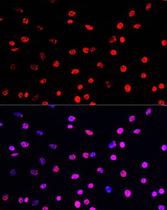 Phospho-Histone H3-T45 Rabbit Polyclonal Antibody - Image 5