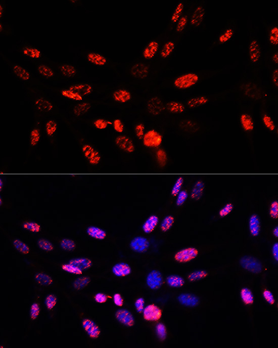 Phospho-Histone H3-T45 Rabbit Polyclonal Antibody - Image 6