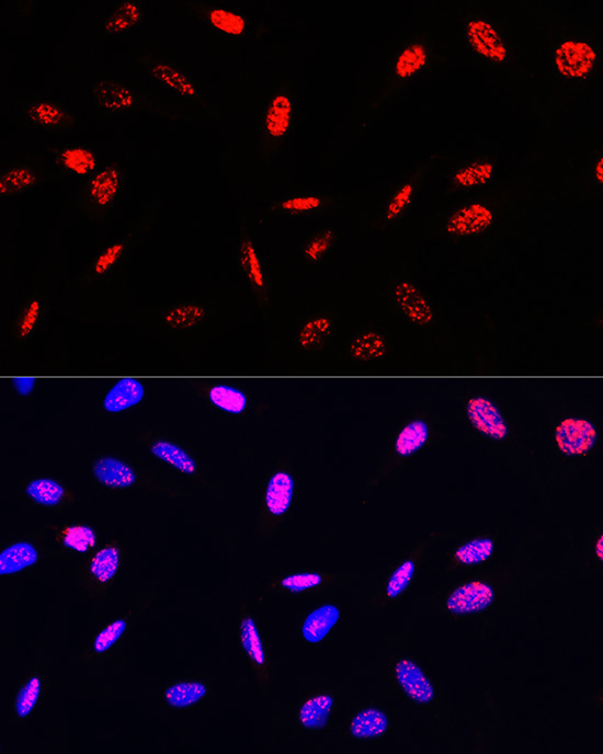 Phospho-Histone H3-T45 Rabbit Polyclonal Antibody - Image 7