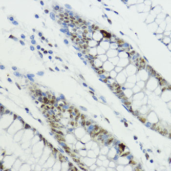 Phospho-Histone H3-T6 Rabbit Polyclonal Antibody - Image 2
