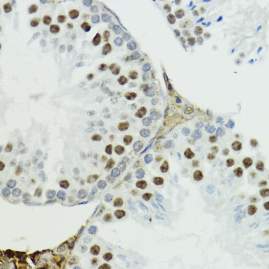 Phospho-Histone H3-T6 Rabbit Polyclonal Antibody - Image 4