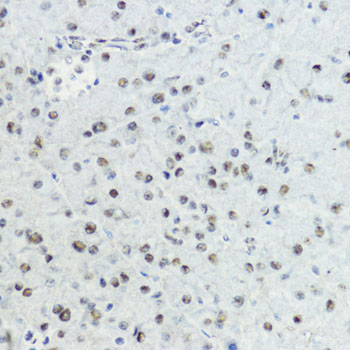 Phospho-Histone H3-T6 Rabbit Polyclonal Antibody - Image 5