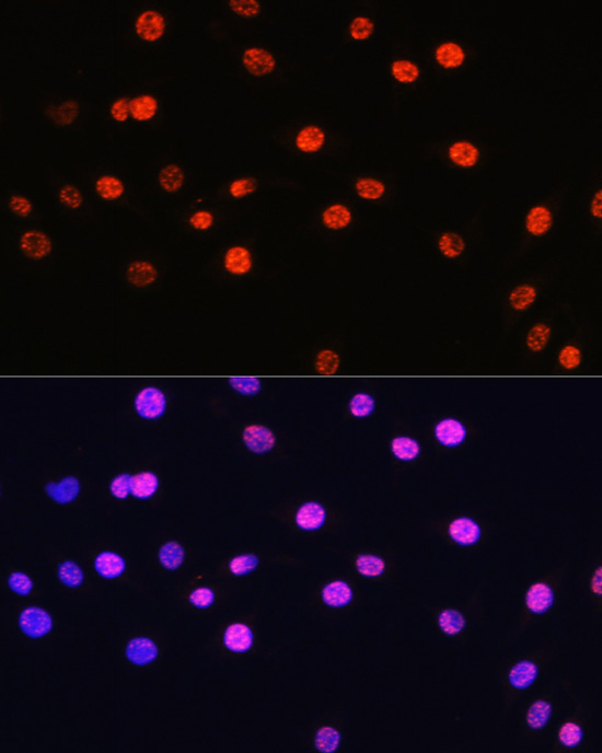 Phospho-Histone H3-T6 Rabbit Polyclonal Antibody - Image 6