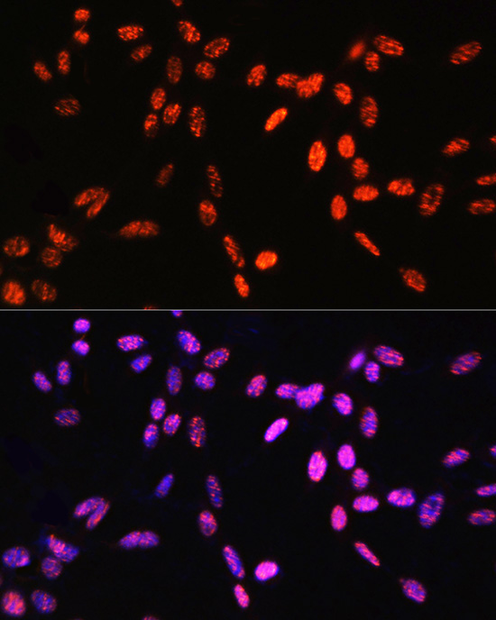 Phospho-Histone H3-T6 Rabbit Polyclonal Antibody - Image 7