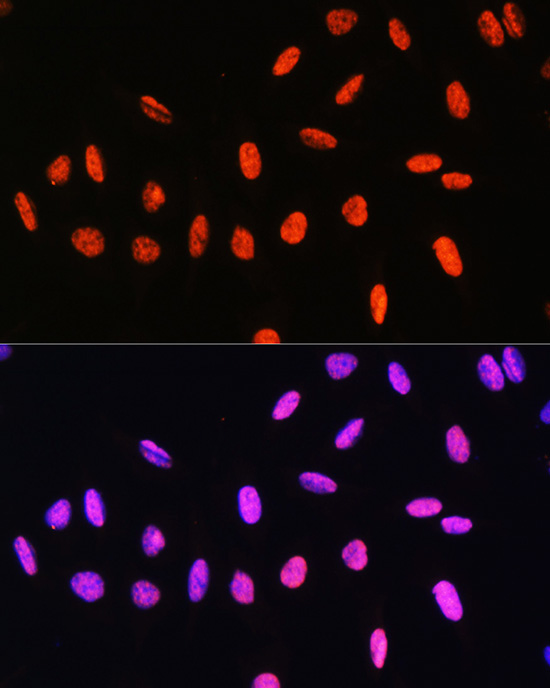 Phospho-Histone H3-T6 Rabbit Polyclonal Antibody - Image 8