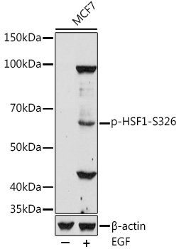 Phospho-HSF1-S326 Rabbit Polyclonal Antibody
