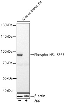 Phospho-HSL-S563 Rabbit Polyclonal Antibody