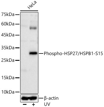 Phospho-HSP27/HSPB1-S15 Rabbit Polyclonal Antibody