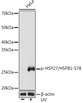 Phospho-HSP27/HSPB1-S78 Rabbit Monoclonal Antibody