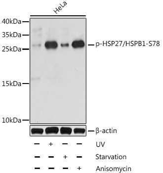 Phospho-HSP27/HSPB1-S78 Rabbit Polyclonal Antibody