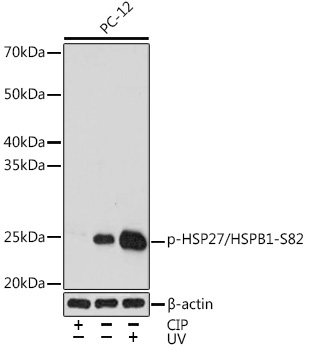 Phospho-HSP27/HSPB1-S82 Rabbit Monoclonal Antibody