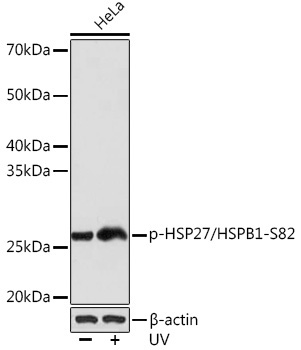 Phospho-HSP27/HSPB1-S82 Rabbit Monoclonal Antibody - Image 2