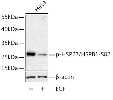 Phospho-HSP27/HSPB1-S82 Rabbit Polyclonal Antibody