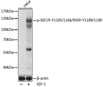 Phospho-IGF1R-Y1165/1166/INSR-Y1189/1190 Rabbit Polyclonal Antibody