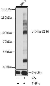 Phospho-IKKAlpha-S180 Rabbit Polyclonal Antibody