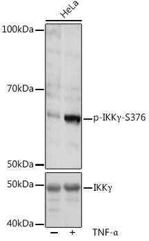Phospho-IKKGamma-S376 Rabbit Polyclonal Antibody - Image 2