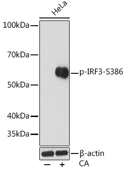 Phospho-IRF3-S386 Rabbit Monoclonal Antibody