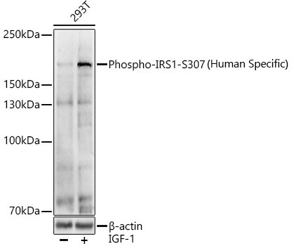 Phospho-IRS1-S307(Human Specific) Rabbit Polyclonal Antibody