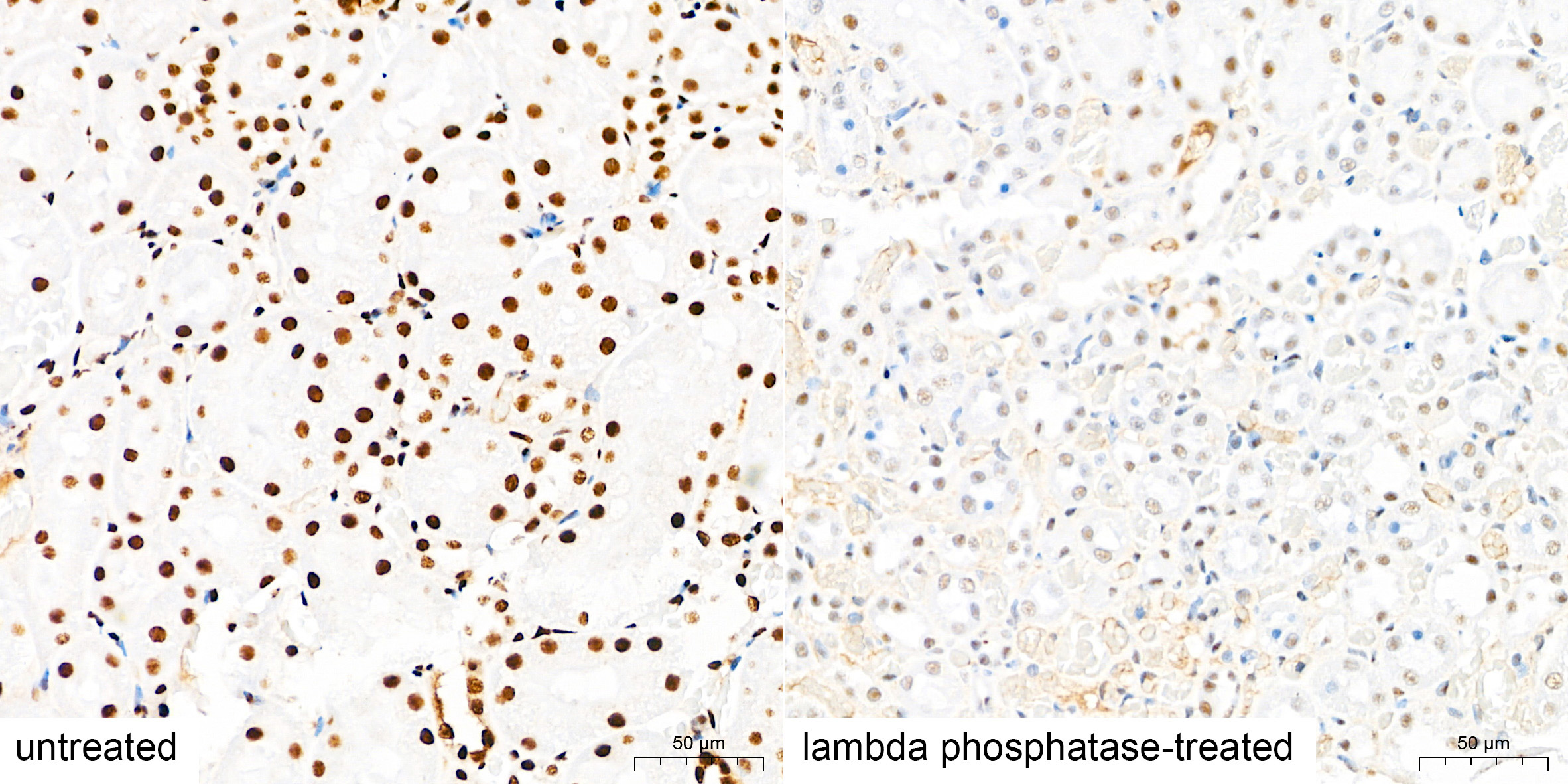 Phospho-IRS1-S307(Human Specific) Rabbit Polyclonal Antibody - Image 2