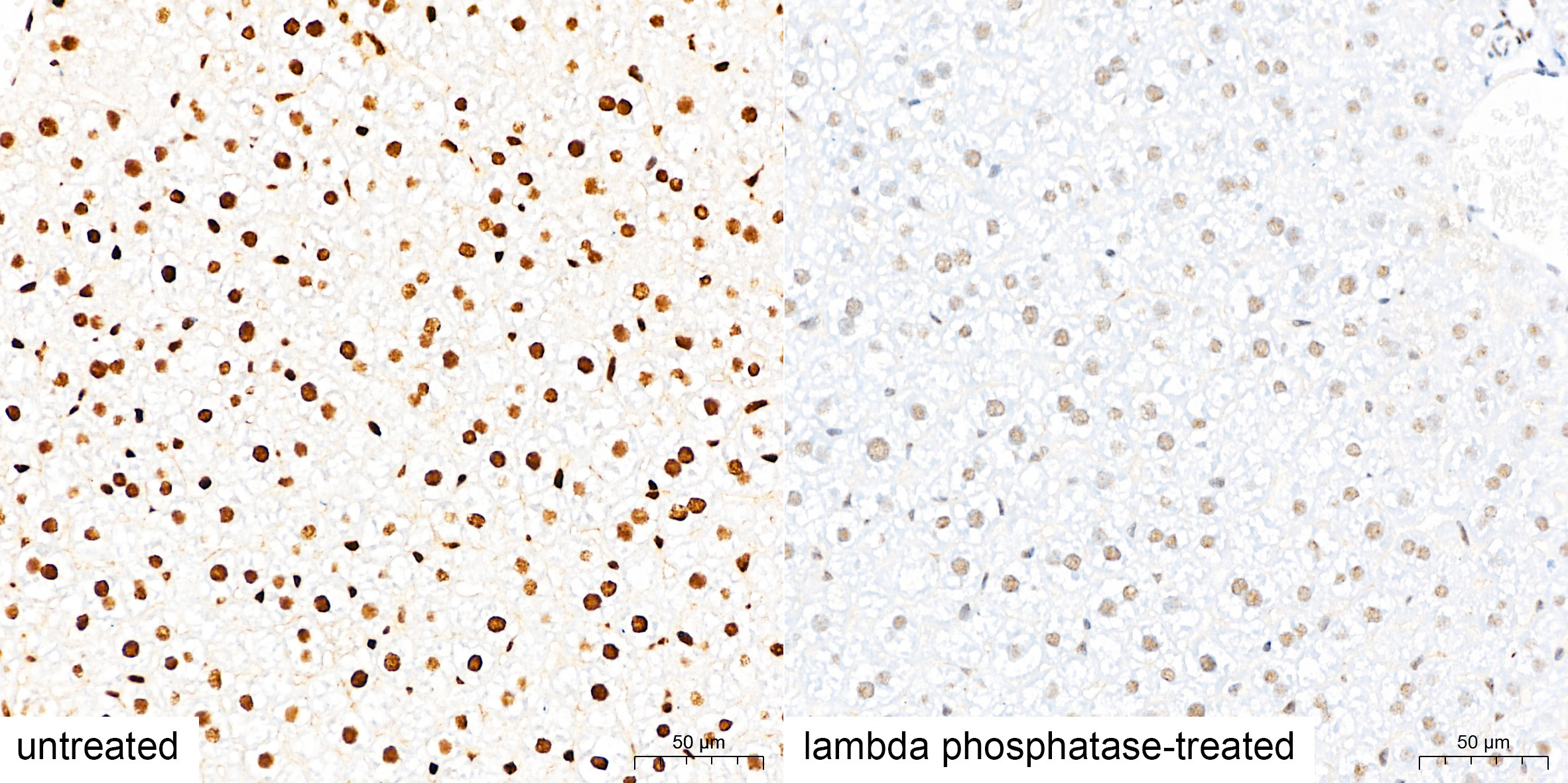 Phospho-IRS1-S307(Human Specific) Rabbit Polyclonal Antibody - Image 3