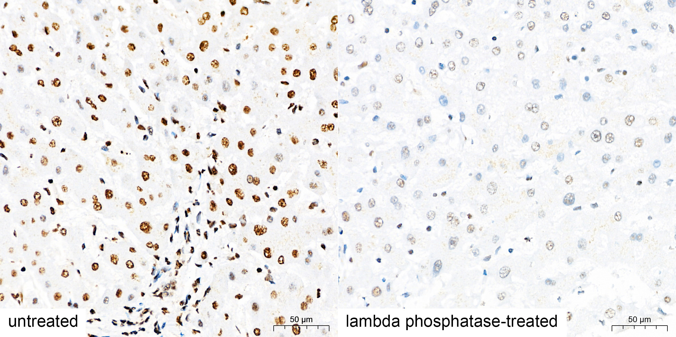 Phospho-IRS1-S307(Human Specific) Rabbit Polyclonal Antibody - Image 4