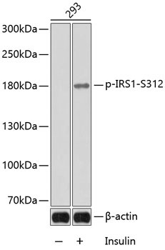 Phospho-IRS1-S312 Rabbit Polyclonal Antibody