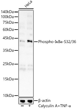 Phospho-I?BAlpha-S32/36 Rabbit Polyclonal Antibody