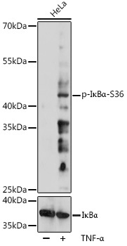 Phospho-I?BAlpha-S36 Rabbit Polyclonal Antibody
