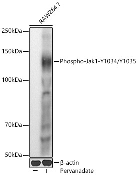 Phospho-Jak1-Y1034/Y1035 Rabbit Polyclonal Antibody