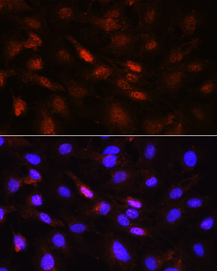 Phospho-Jak1-Y1034/Y1035 Rabbit Polyclonal Antibody - Image 2
