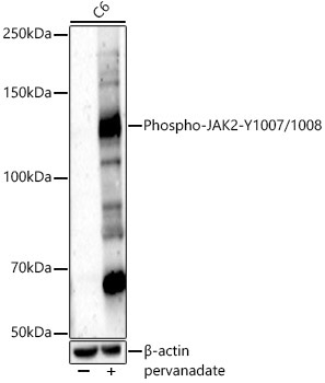 Phospho-JAK2-Y1007/1008 Rabbit Polyclonal Antibody