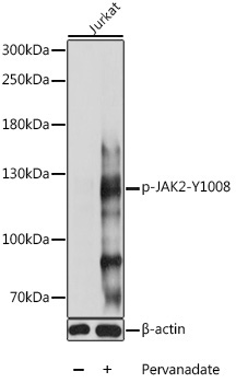 Phospho-JAK2-Y1008 Rabbit Polyclonal Antibody