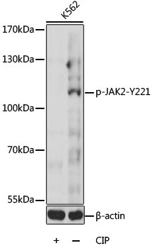 Phospho-JAK2-Y221 Rabbit Polyclonal Antibody