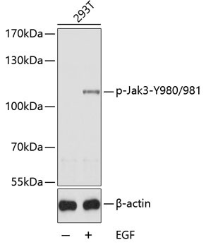 Phospho-Jak3-Y980/981 Rabbit Polyclonal Antibody