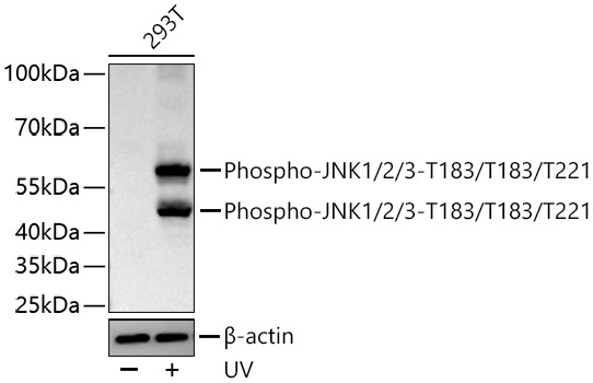 Phospho-JNK1/2/3-T183/T183/T221 Rabbit Monoclonal Antibody